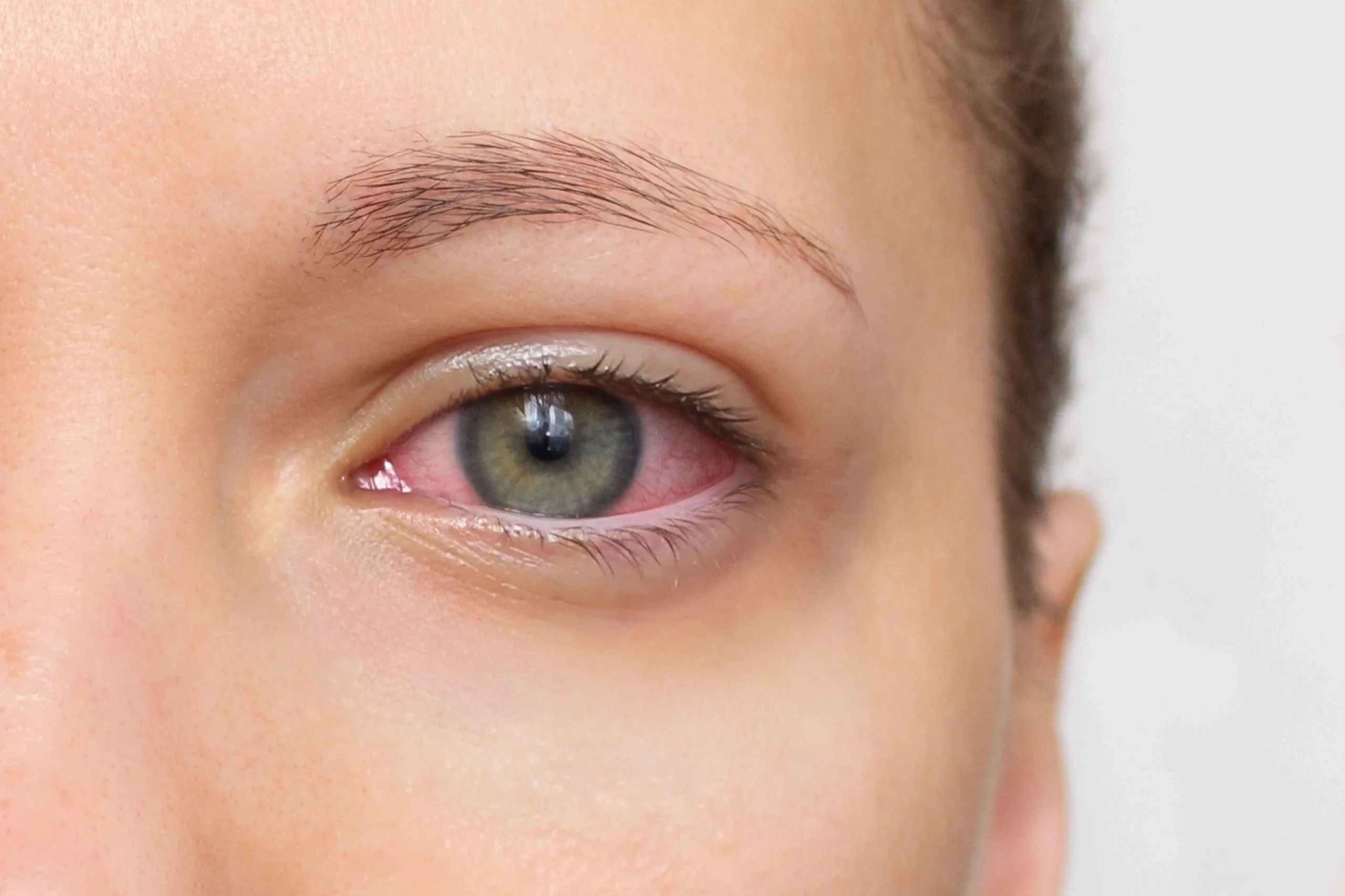 Dry Eye Disease Treatment